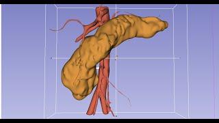 7. Pancreas and vessels with grow from seeds, and why you should always use crop volume