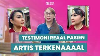 Ratna Listy Lebih Percaya Diri Setelah Operasi Hidung Di Klinik Bedah Plastik Queen | Testimoni Real