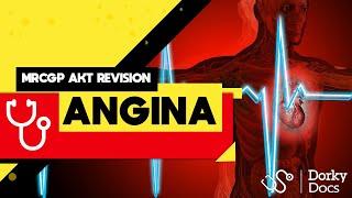 Angina | MRCGP AKT Revision - Dorky Docs