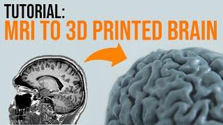 How To 3D Print Your Brain In A Few Simple Steps - TUTORIAL 2022