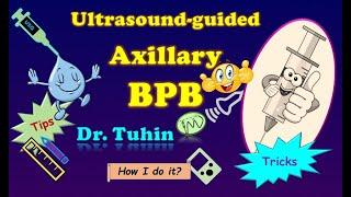 Tips & Tricks of Axillary Brachial Plexus Block | ultrasound| Perivascular | Perineural @DrTuhinM