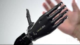 Top 5 bionic arm