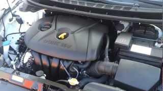 New Hyundai Elantra Sedan Engine Bay Review