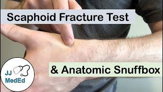 Scaphoid Fracture Test (Clinical Exam) and the Anatomic Snuffbox