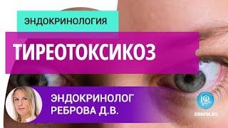 Эндокринолог Реброва Д.В.: Тиреотоксикоз