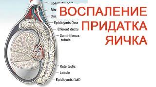 Воспаление придатка яичкам / Доктор Черепанов