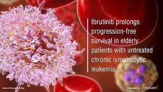 Ibrutinib prolongs progression-free survival in elderly patients with untreated CLL