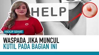 AWAS! Kutil Kelamin Bisa Menular, Kenali Cirinya | Tips Sehat