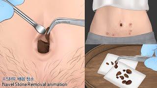 [ASMR] belly care Animation