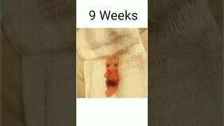 7 Weeks to 10 Weeks pregnancy baby abortions#shorts#malayalam #viral #trending #pregnancy