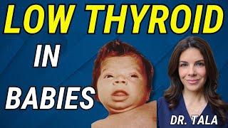 Doctor reviews: Symptoms, Labs and Treatment of CONGENITAL Hypothyroidism