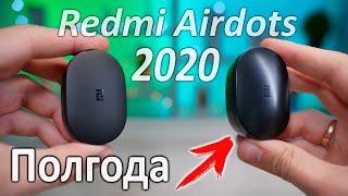 Обзор Redmi AirDots, опыт использования Xiaomi Mi True Wireless Earbuds Basic.