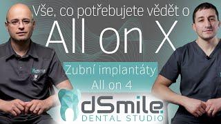 Vše o zubních implantátech All on X: Kompletní průvodce #dsmile #implantace