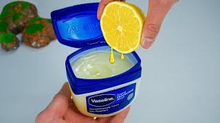 Mix Vaseline with Lemon and you will be shocked! If only I had known about this earlier!