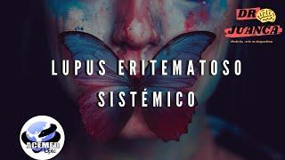 Lupus Eritematoso Sistémico ACEMED UPTC