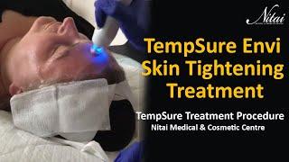 TempSure Envi Treatment at Nitai Medical and Cosmetic Centre - Melbourne