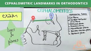 cephalometrics in orthodontics - orthodontics lecture