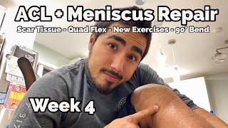 ACL + Meniscus Repair - Week 4 Update