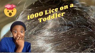 Lice Treatment for a Crying Toddler | 1000+ Head Lice Infestation | Millions and Millions Of Lice