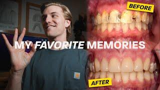 3 Moments That Made Dental School WORTH IT