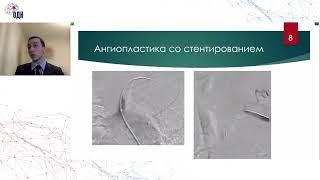 Клинические примеры: хирургия церебральных артерий. к.м.н. Жердев Н.Н.