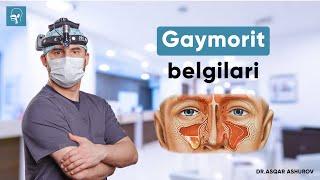 Gaymarit belgilari | Dr. Ashurov