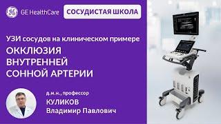 Сосудистая школа GE Healthcare. Окклюзия внутренней сонной артерии. Сессия №11