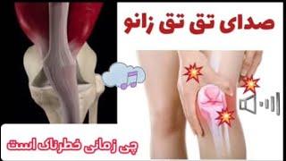 چی زمانی صدا دادن زانو نیاز به درمان دارد؟When knee cripitus needs treatment