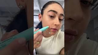 Easy Dermatologist Approved Acne Solution | Clinique Acne Solutions Emergency Touch Stick