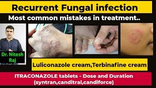 दाद ,खाज ,खुजली ,दिनाय ,ringworm ka ilaz.Treatment of fungal infection of skin, hair,Dr Nitesh Raj