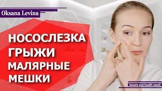 Как избавиться от малярных мешков? Устранить носослезную борозду, убрать грыжи, отёки и морщинки