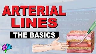 What is an A-line? Arterial Line Basics EXPLAINED!