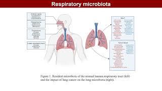 iMeta | Role of respiratory system microbiota in development of lung cancer and clinical application