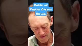 Bekas operasi di hidung