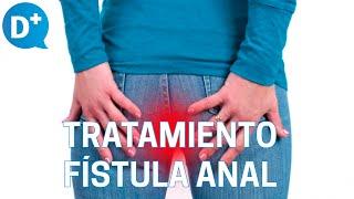 Diagnóstico y tratamiento de la fístula anal