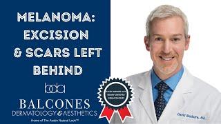 Melanoma Excision & Scars Left Behind | David Bushore, M.D. | Austin, TX | Ph: 512-459-4869