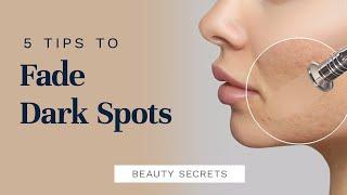 5 Secrets to Fading Dark Spots | City Beauty