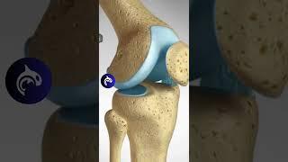 Learn How An ACL MCL Tear is Repaired - 3D Animation