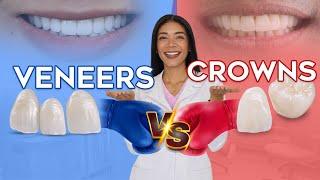 VENEERS VS. CROWNS - WHAT YOU NEED TO KNOW BEFORE CHOOSING