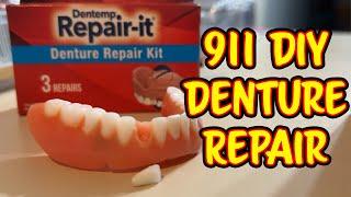 Emergency DIY Denture Repair
