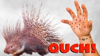 Porcupine Quills Human Hand! (and How to Remove Them)