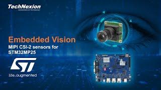 ST STM32MP25 Embedded Vision (camera) Solutions