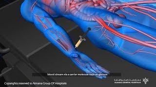 التصوير المقطعي بالاصدار البوزتروني PET SCAN