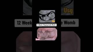 12 weeks baby playing inside Womb during ultrasound scan