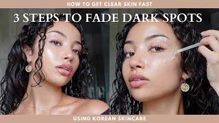 HOW TO FADE DARK SPOTS FAST | 3 steps | skincare facts & tips for acne