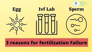 3 Reasons for Failed Fertilisation after IVF | Malpani Infertility Clinic