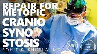 Frontal Orbital Advancement for Repair of Metopic Craniosynostosis - Dr. Rohit K. Khosla