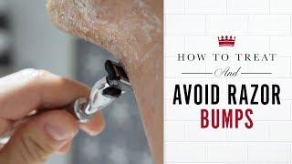 How to Treat and Avoid Razor Bumps