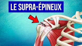 Tendinite du supra épineux à l'épaule : Explication et Traitement