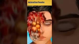 3D Animation Treatment #shorts #short #facts #viral #humanity #animation #youtubeshorts #3d #help